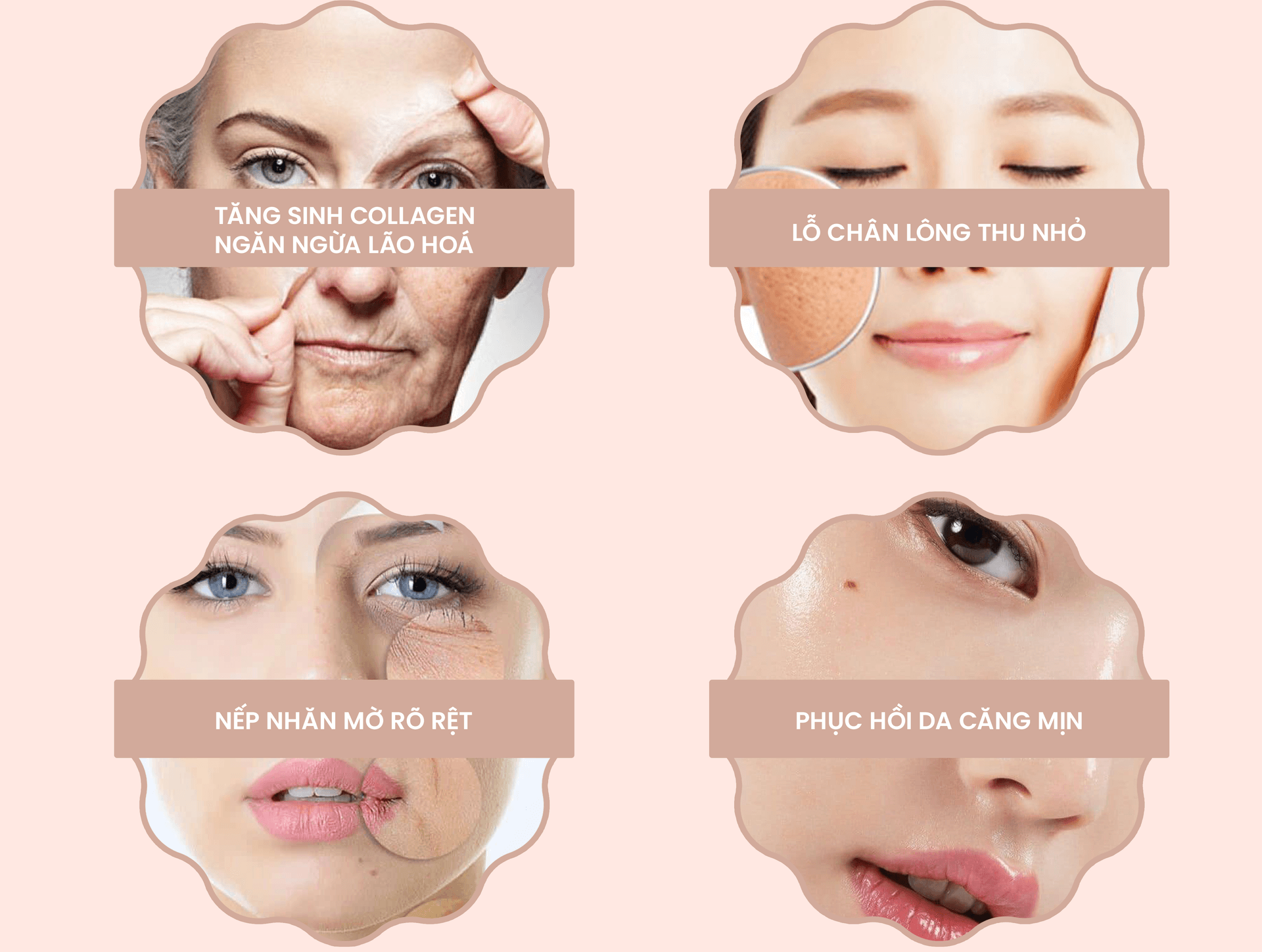 4 lợi ích chính của công nghệ Meso